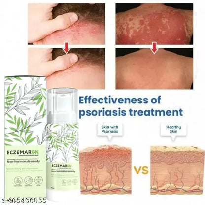 Eczemaron for Ringworm, Itching, Eczema & Fungal Infection Antifungal Cream (Pack of 2)